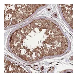 Atlas Antibodies Anti-ADAMTS3 Antibody