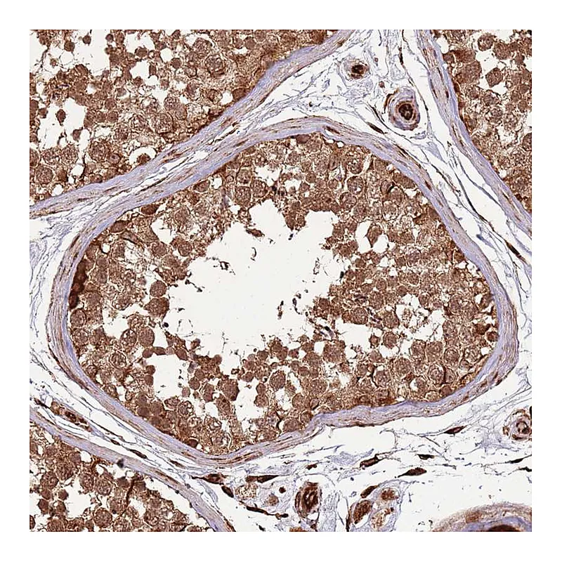 Atlas Antibodies Anti-ADAMTS3 Antibody