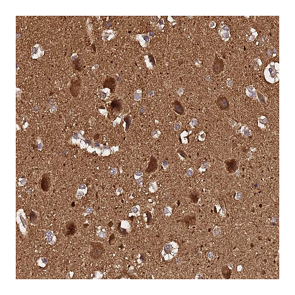 Atlas Antibodies Anti-ADAMTS18 Antibody