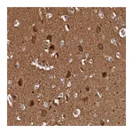 Atlas Antibodies Anti-ADAMTS18 Antibody