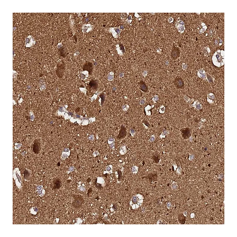 Atlas Antibodies Anti-ADAMTS18 Antibody