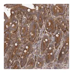 Atlas Antibodies Anti-ADAMTS20 Antibody
