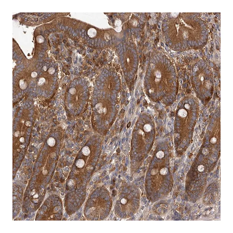 Atlas Antibodies Anti-ADAMTS20 Antibody