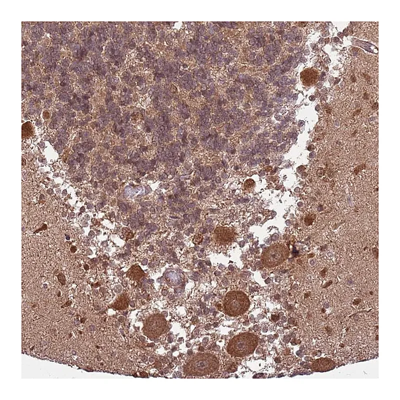 Atlas Antibodies Anti-ADAMTS3 Antibody