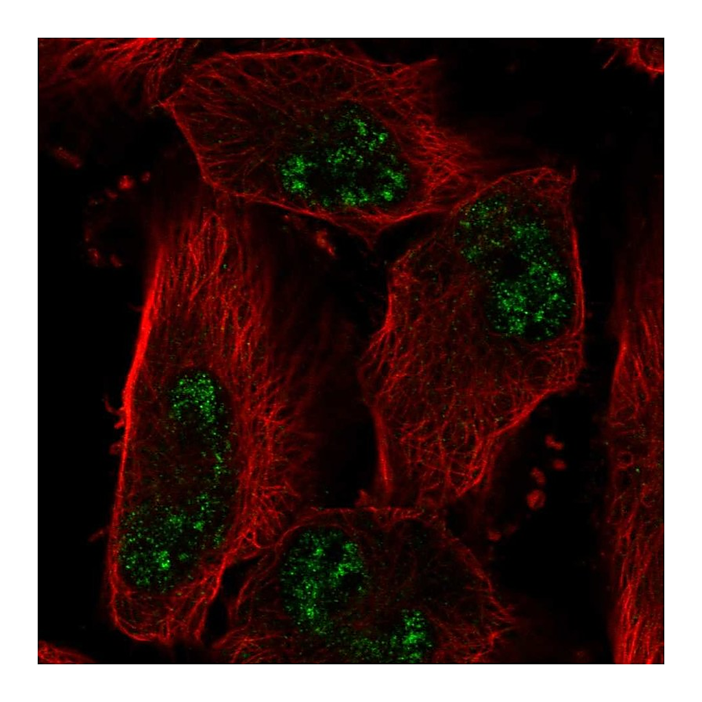 Atlas Antibodies Anti-ADAMTS4 Antibody