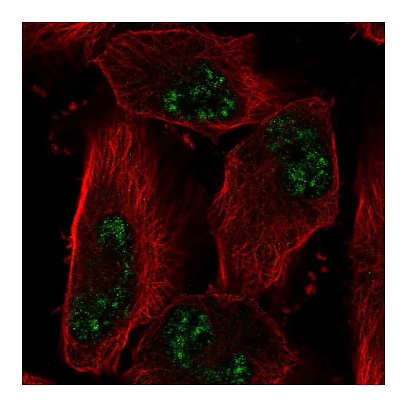 Atlas Antibodies Anti-ADAMTS4 Antibody