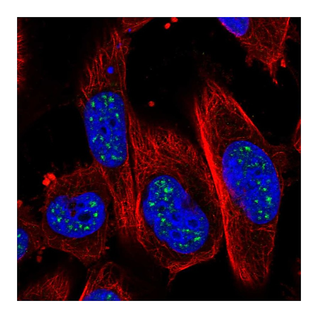 Atlas Antibodies Anti-ADAMTS4 Antibody