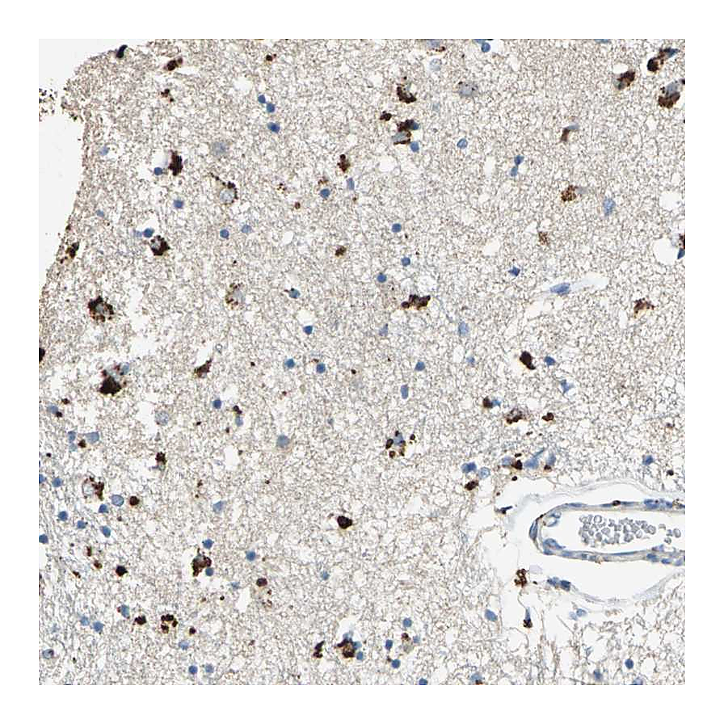 Atlas Antibodies Anti-ADAMTS5 Antibody