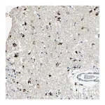 Atlas Antibodies Anti-ADAMTS5 Antibody