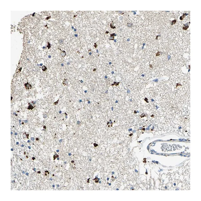 Atlas Antibodies Anti-ADAMTS5 Antibody