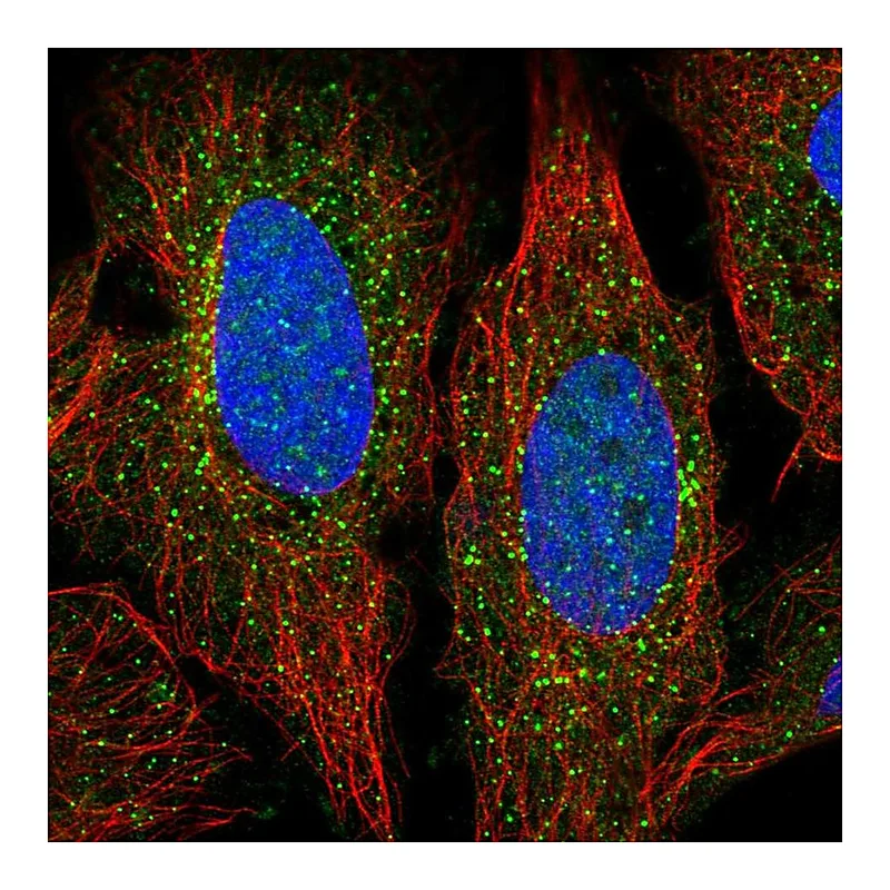 Atlas Antibodies Anti-ADAMTS7 Antibody