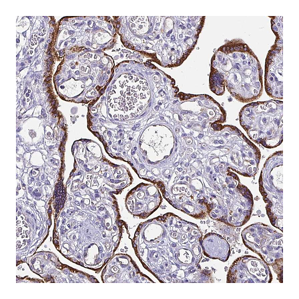 Atlas Antibodies Anti-ADAMTS6 Antibody