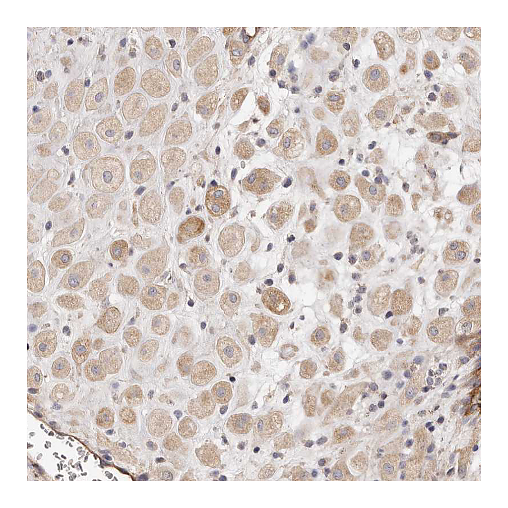 Atlas Antibodies Anti-ADAMTS9 Antibody