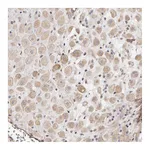 Atlas Antibodies Anti-ADAMTS9 Antibody
