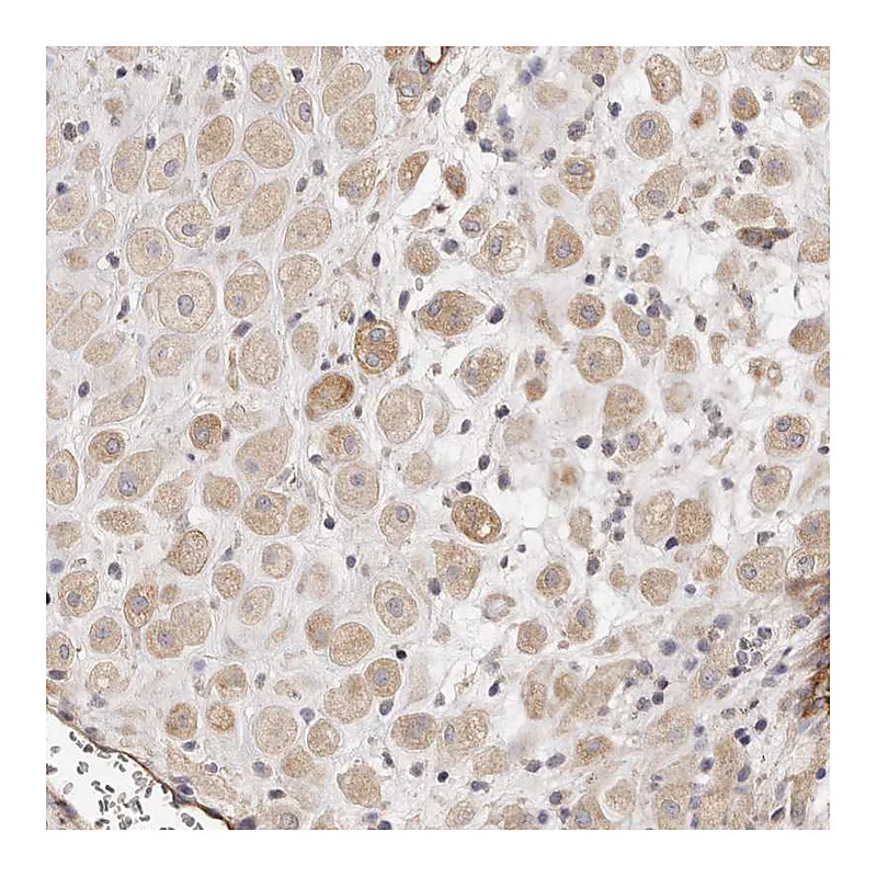 Atlas Antibodies Anti-ADAMTS9 Antibody