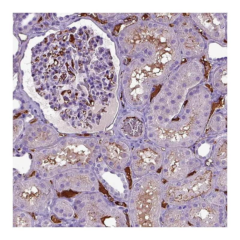 Atlas Antibodies Anti-ADAMTS8 Antibody