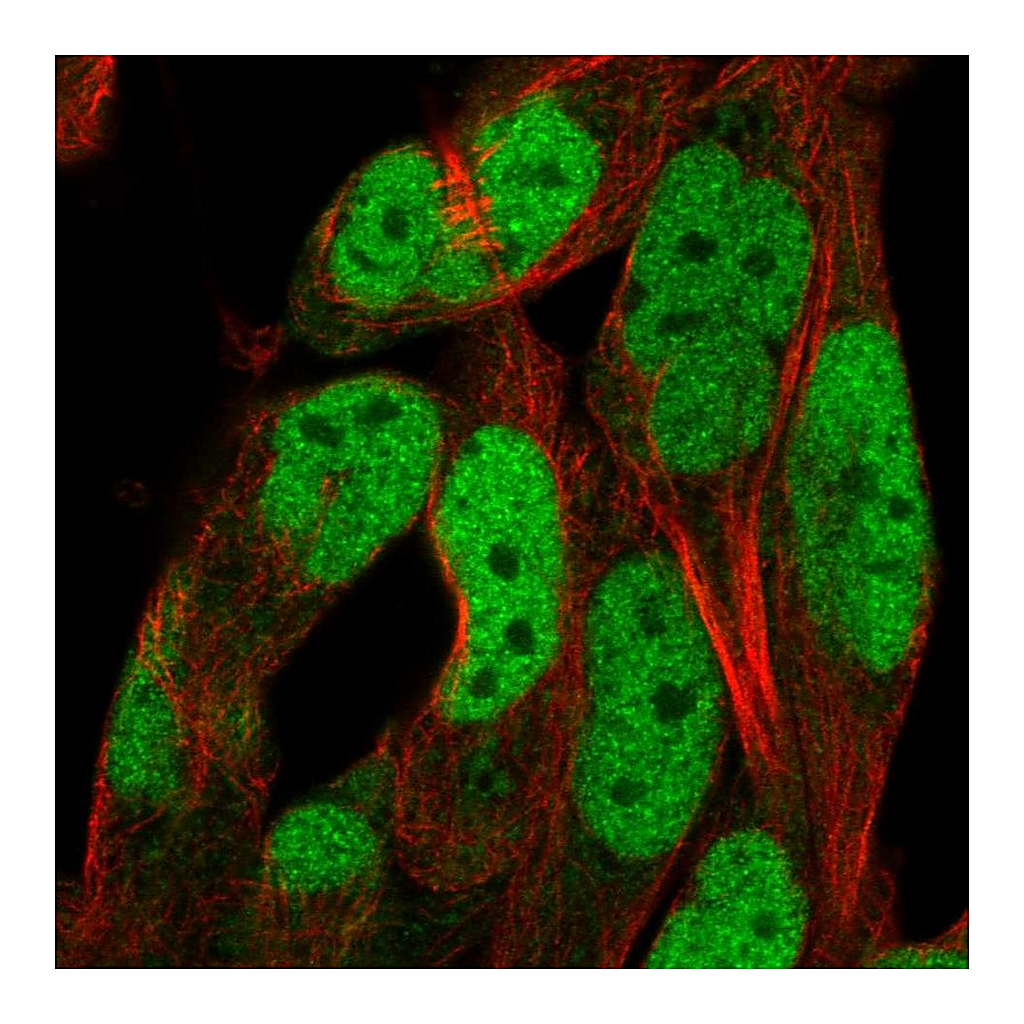 Atlas Antibodies Anti-ADAMTS5 Antibody