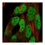 Atlas Antibodies Anti-ADAMTS5 Antibody