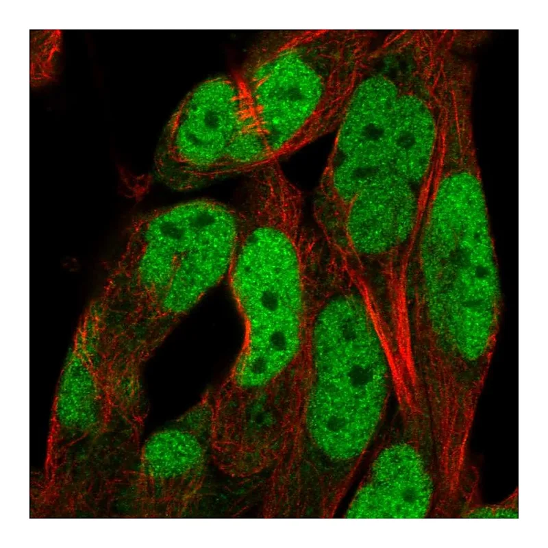 Atlas Antibodies Anti-ADAMTS5 Antibody