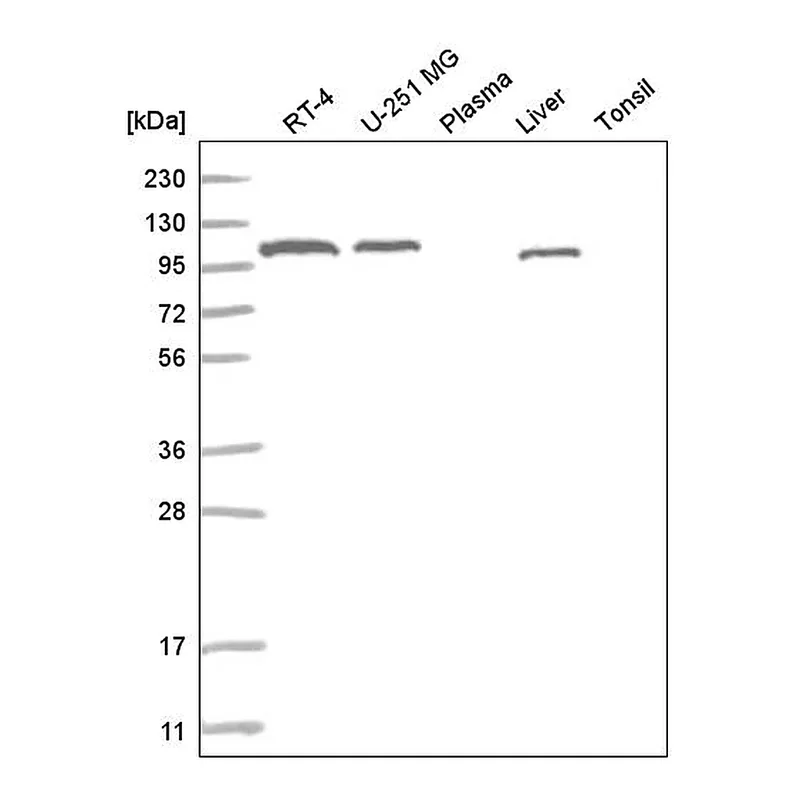 Atlas Antibodies Anti-ADAMTS9 Antibody