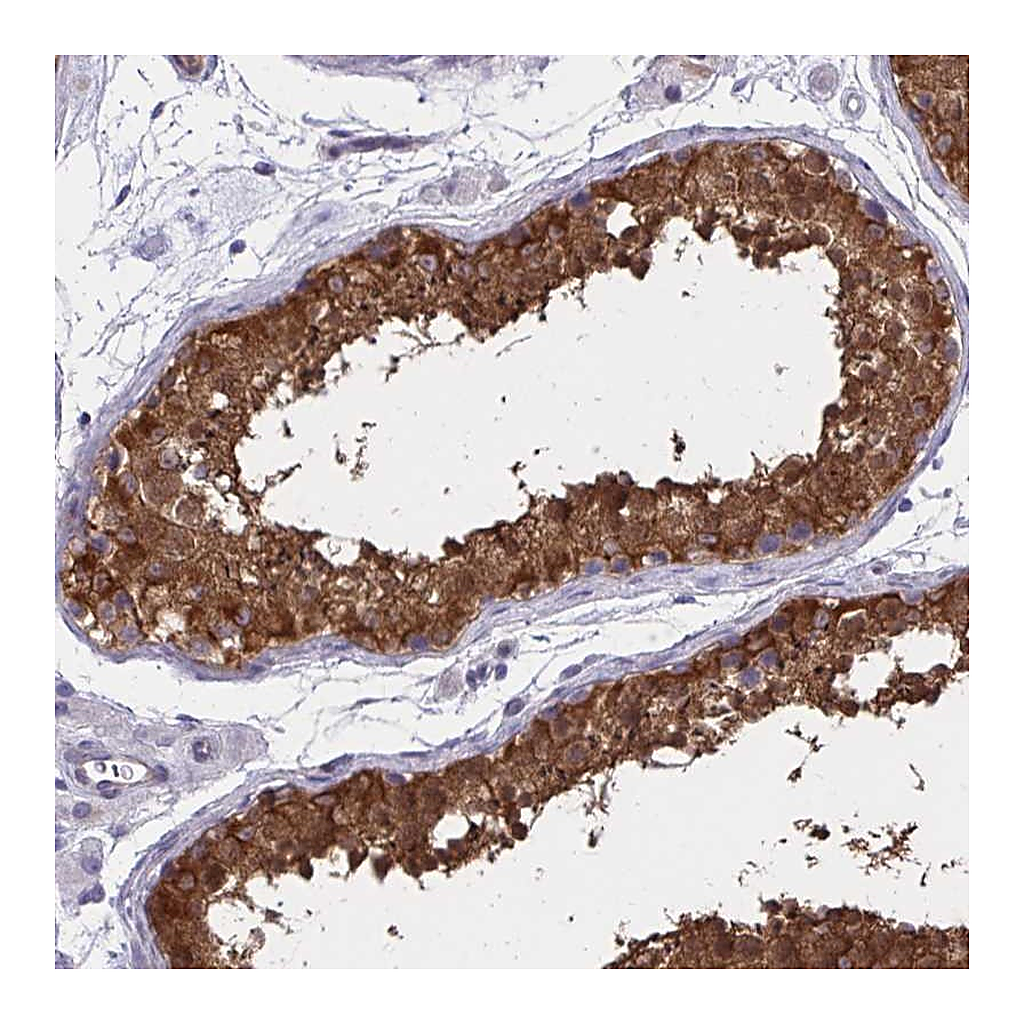 Atlas Antibodies Anti-ADAMTSL1 Antibody
