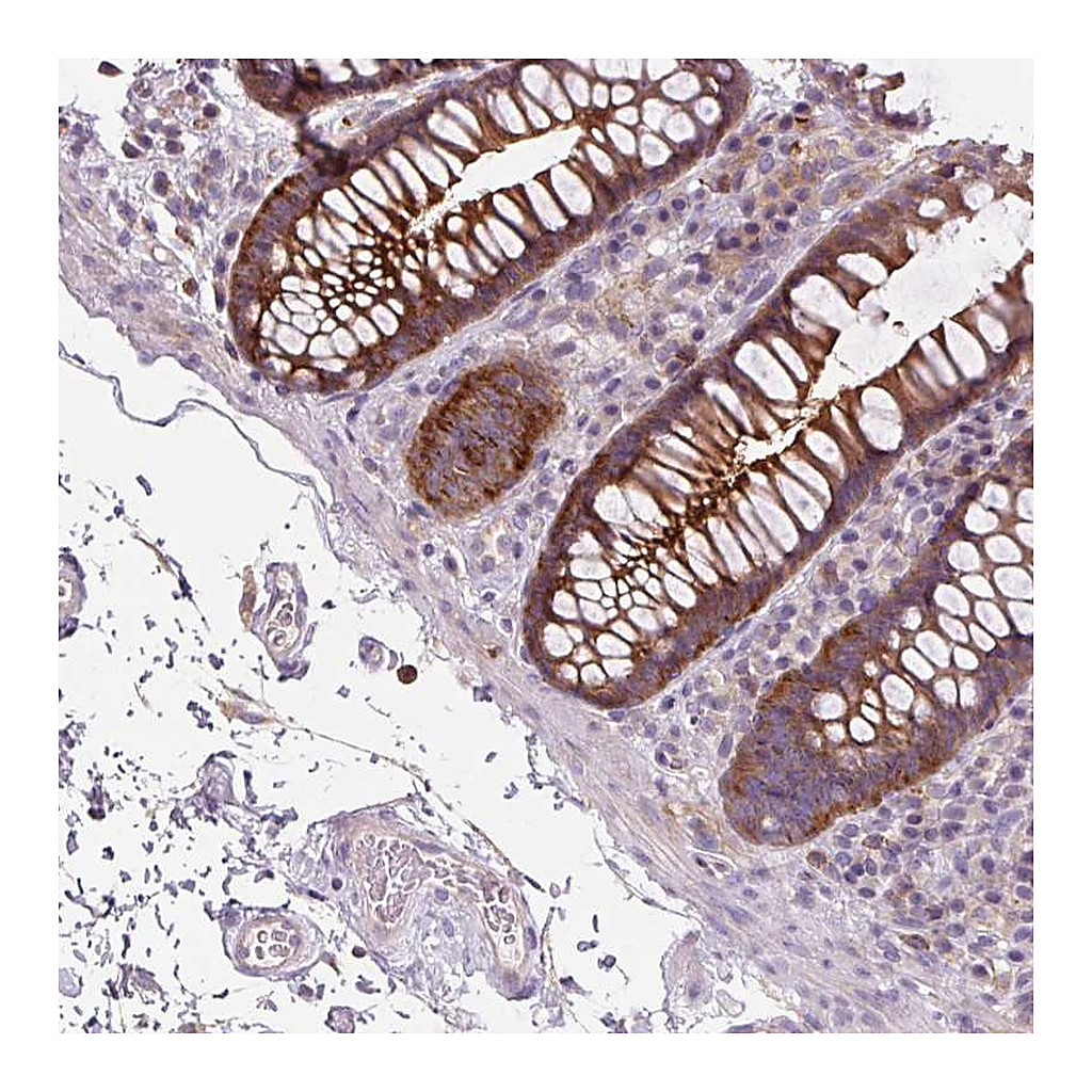 Atlas Antibodies Anti-ADAMTSL2 Antibody