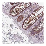 Atlas Antibodies Anti-ADAMTSL2 Antibody
