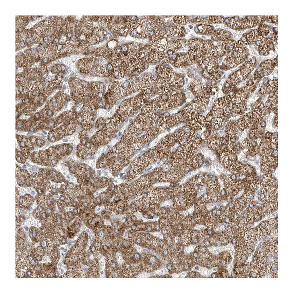 Atlas Antibodies Anti-ADAMTSL3 Antibody