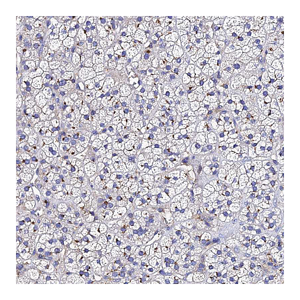 Atlas Antibodies Anti-ADAMTSL2 Antibody