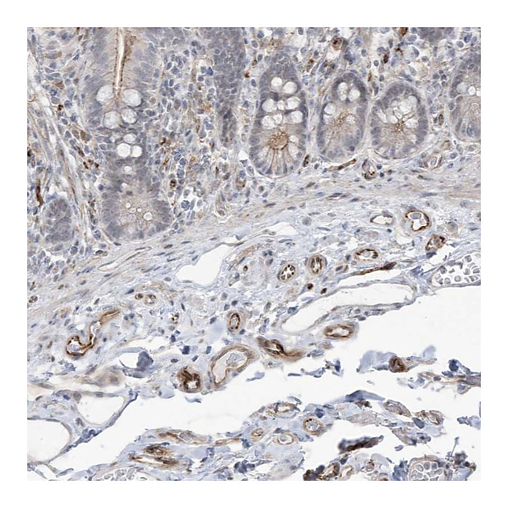 Atlas Antibodies Anti-ADAMTSL3 Antibody
