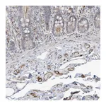 Atlas Antibodies Anti-ADAMTSL3 Antibody