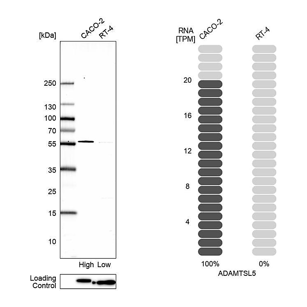 Atlas Antibodies Anti-ADAMTSL5 Antibody