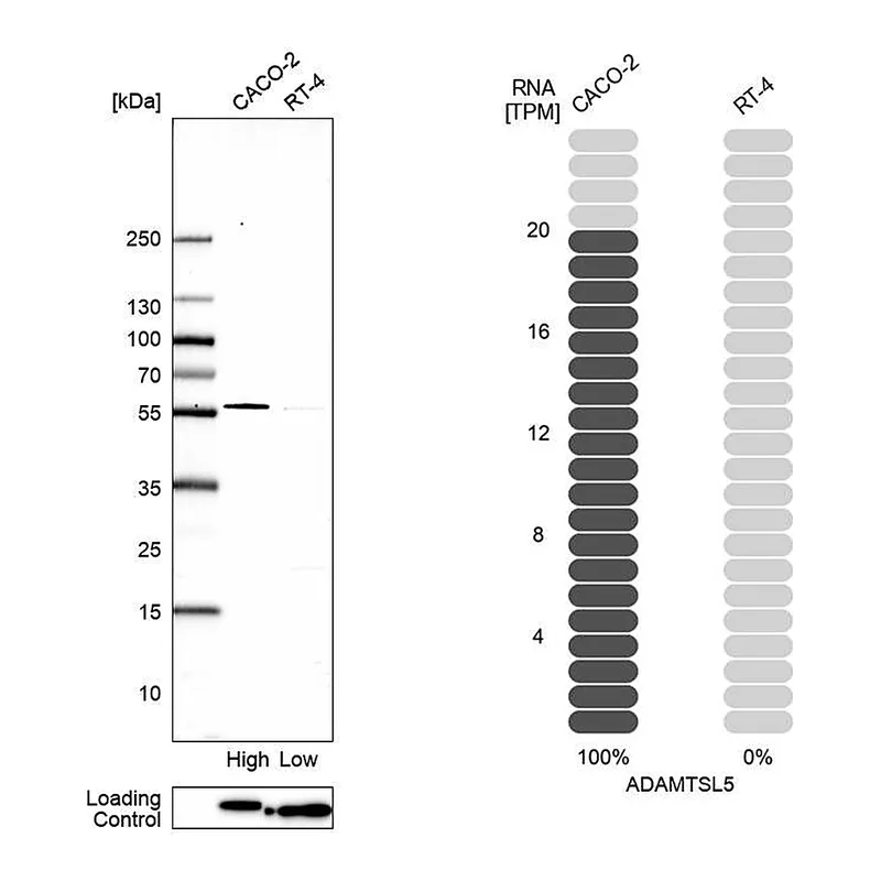 Atlas Antibodies Anti-ADAMTSL5 Antibody