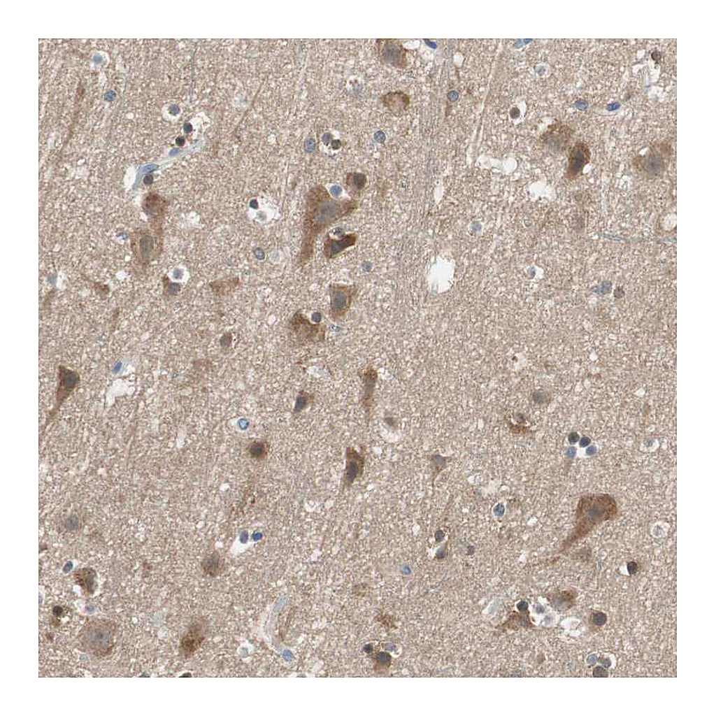 Atlas Antibodies Anti-ADAP1 Antibody