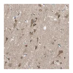 Atlas Antibodies Anti-ADAP1 Antibody
