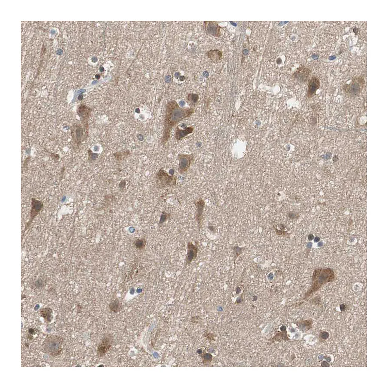 Atlas Antibodies Anti-ADAP1 Antibody