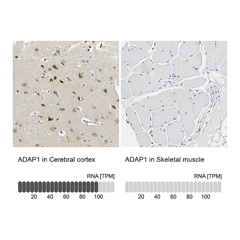 Atlas Antibodies Anti-ADAP1 Antibody