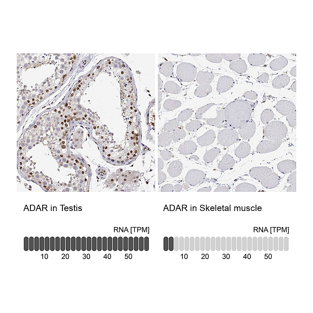 Atlas Antibodies Anti-ADAR Antibody