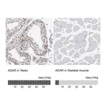 Atlas Antibodies Anti-ADAR Antibody