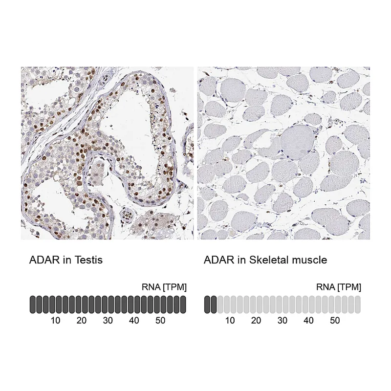 Atlas Antibodies Anti-ADAR Antibody