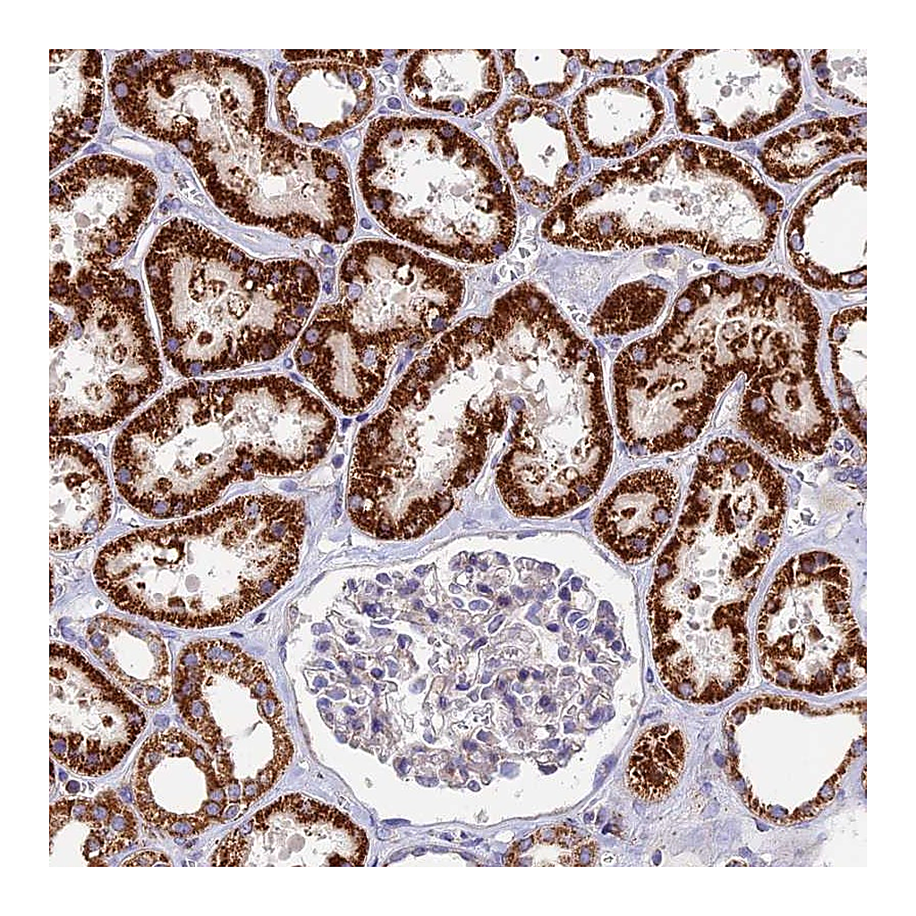 Atlas Antibodies Anti-ADAT1 Antibody