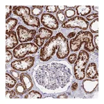 Atlas Antibodies Anti-ADAT1 Antibody