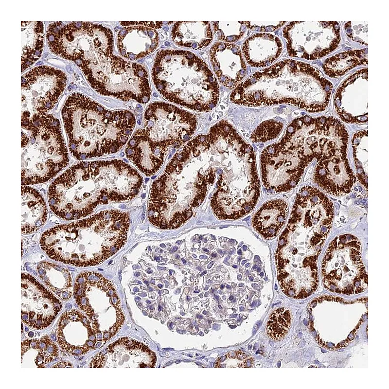 Atlas Antibodies Anti-ADAT1 Antibody