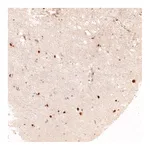Atlas Antibodies Anti-ADARB1 Antibody