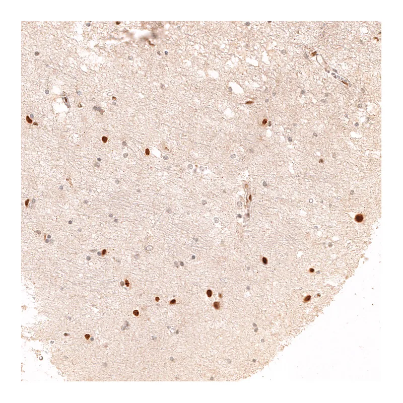 Atlas Antibodies Anti-ADARB1 Antibody