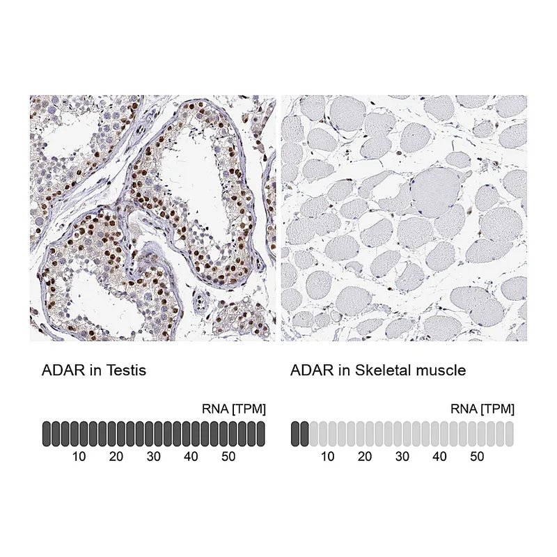Atlas Antibodies Anti-ADAR Antibody