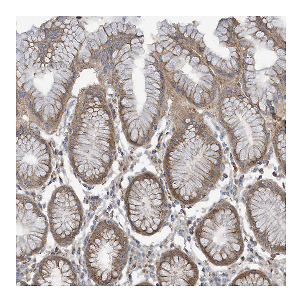 Atlas Antibodies Anti-ADAT2 Antibody