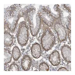 Atlas Antibodies Anti-ADAT2 Antibody
