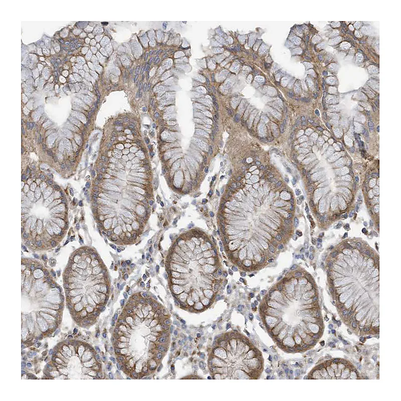 Atlas Antibodies Anti-ADAT2 Antibody