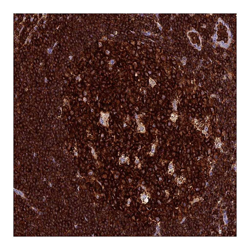 Atlas Antibodies Anti-ADAT1 Antibody